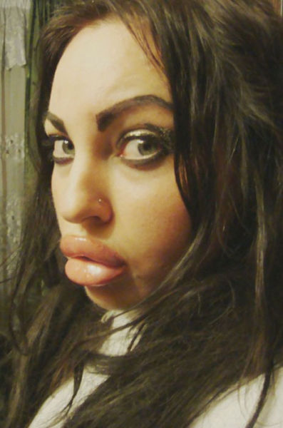 Ladies With Silicone Overdose