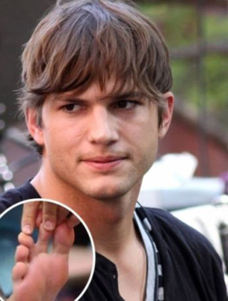 Celebs Have Imperfections Too!