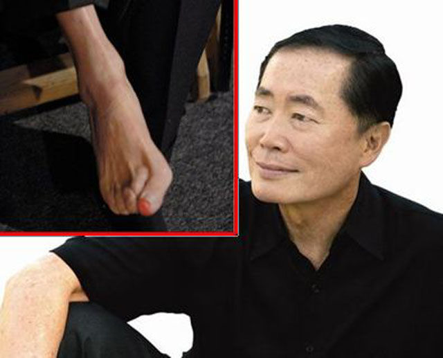 Celebs Have Imperfections Too!