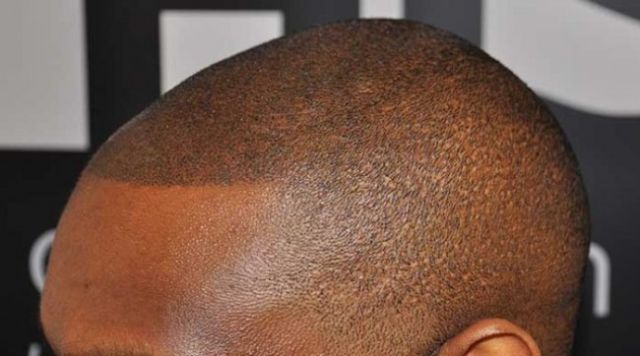 The ‘No Hair’ Solution!