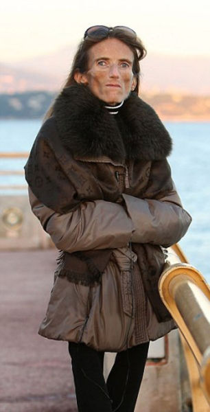 Her Dream Body Is Killing Her