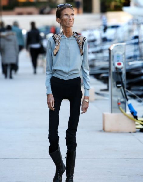 Her Dream Body Is Killing Her