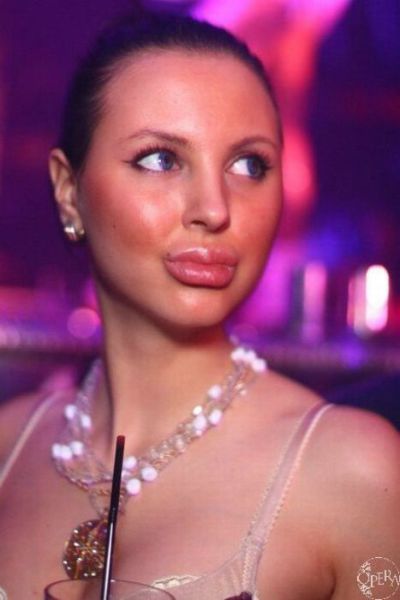 Sometimes Beauty Treatments Just Make You Ugly