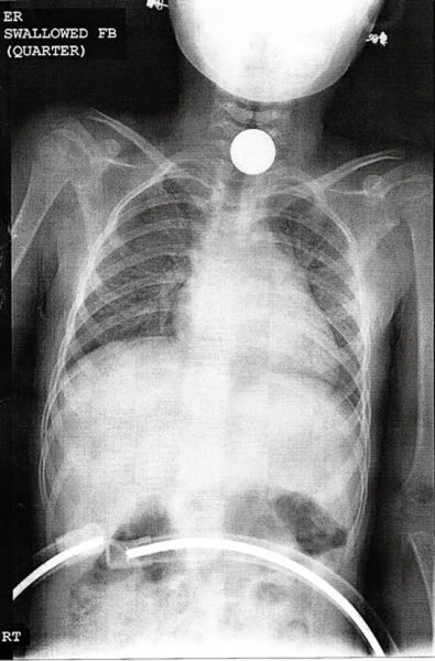 Real X-Rays That Will Shock and Astound You