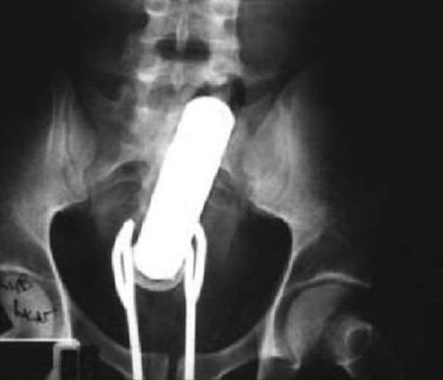 Real X-Rays That Will Shock and Astound You