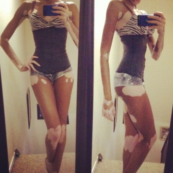 The Top Model without Stereotypical Good Looks