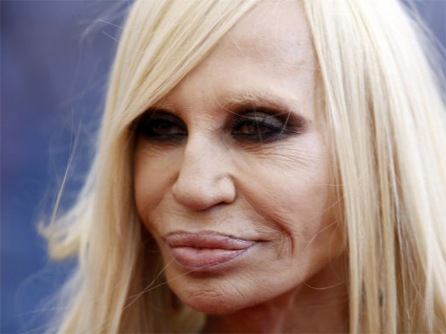 Plastic Surgery Fails That Are Just Wrong