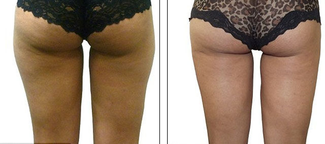 English Graduate Trades in Books for Beauty