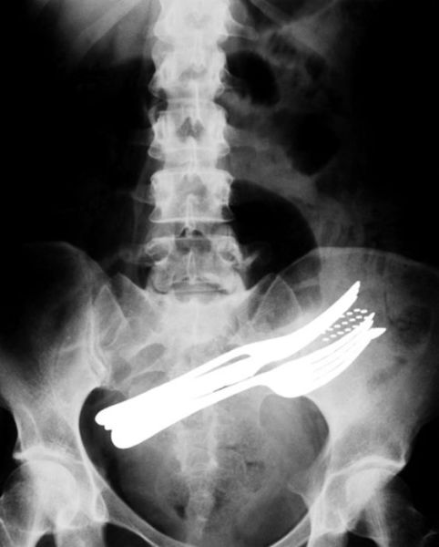 Real X-Rays That Are Will Shock You