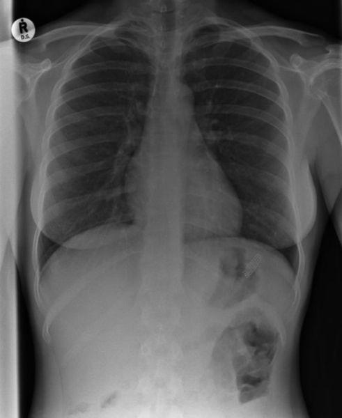 Real X-Rays That Are Will Shock You