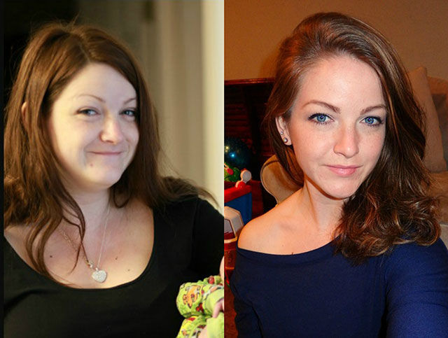 Once Chubby, Now Thin