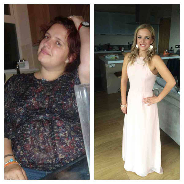 Gorgeous Girls Who Used to Be Fat