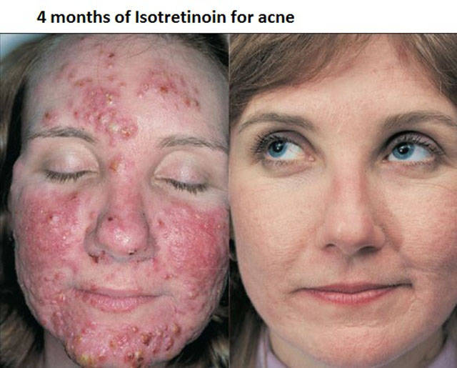 morning picdump 50 pics 20.html - 50 HD Photos | Premium Gallery 2015