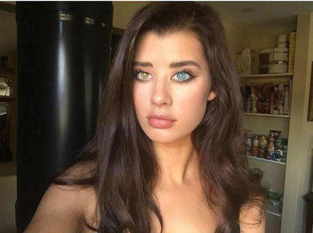 The Gorgeous Model Who Has a Very Unique Beauty Feature