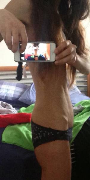 formerly anorexic girl enters a bodybuilding competition 26 pics 23.html - 26 HD Photos | Premium Gallery 2016