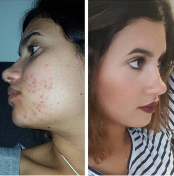How Makeup Nicely Done Can Conceal Girls