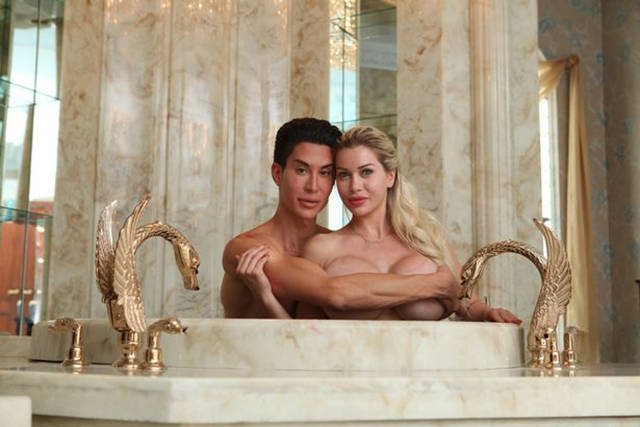 Real-Life Ken And Barbie Couple Highly Addicted To Surgery