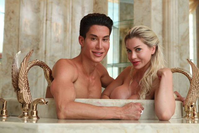 Real-Life Ken And Barbie Couple Highly Addicted To Surgery